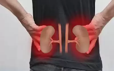 كثرة هذا الفيتامين تدمر الكلى