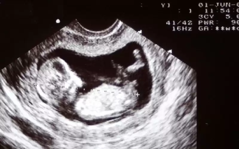 متى تسمع الحامل دقات قلب الجنين؟