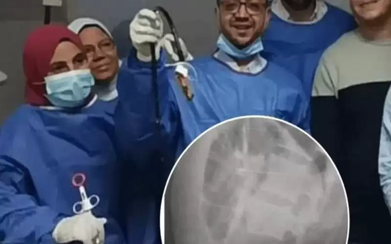 بالفيديو .. اطباء يسحبون هاتفا من