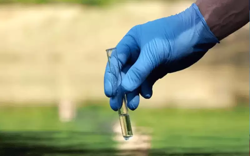 الاحتلال يرصد تلوثا بالكوليرا ويرجح انتقاله