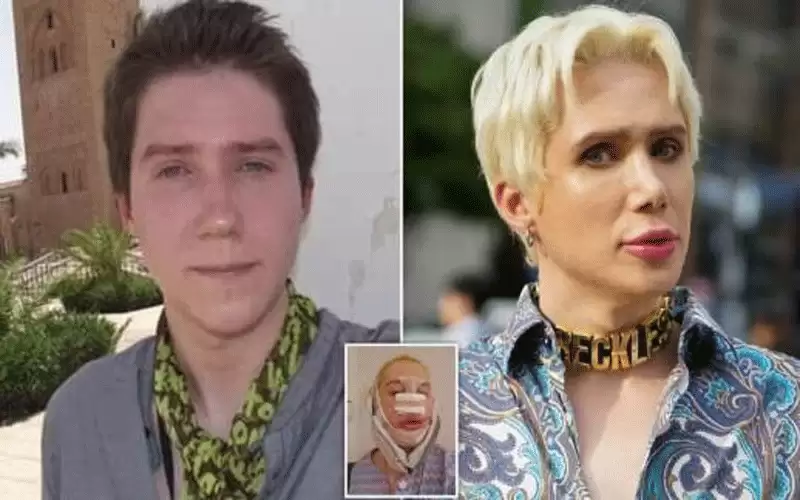 بالفيديو: متحول يعلن ندمه الشديد ويرغب