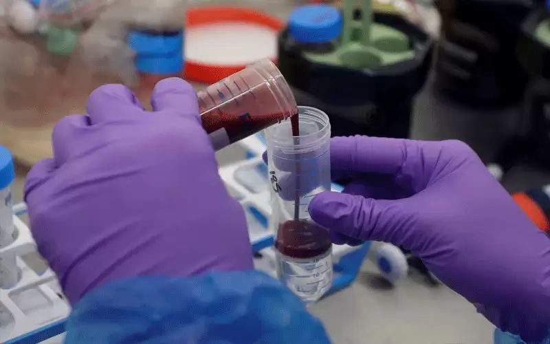 تحليل دم يرصد سرطان الثدي قبل