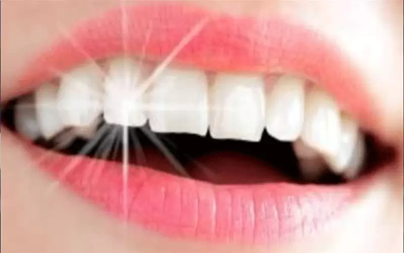 أمراض الفم تصيب 3.5 مليارات شخص