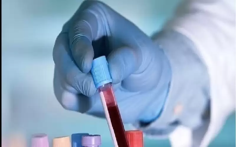 اختبار دم ثوري يتنبأ بعودة سرطان