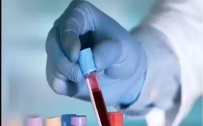 اختبار دم ثوري يتنبأ بعودة سرطان