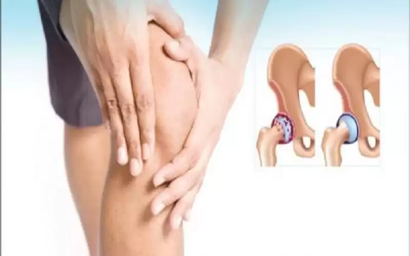 أسباب ألم المفاصل