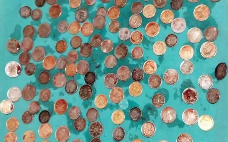 استخراج 187 قطعة نقدية من معدة