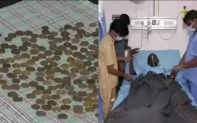 هندي يبتلع 187 قطعة نقدية معدنية
