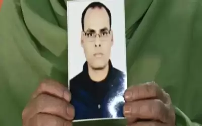 دخل لإجراء عملية زرع شعر فخرج