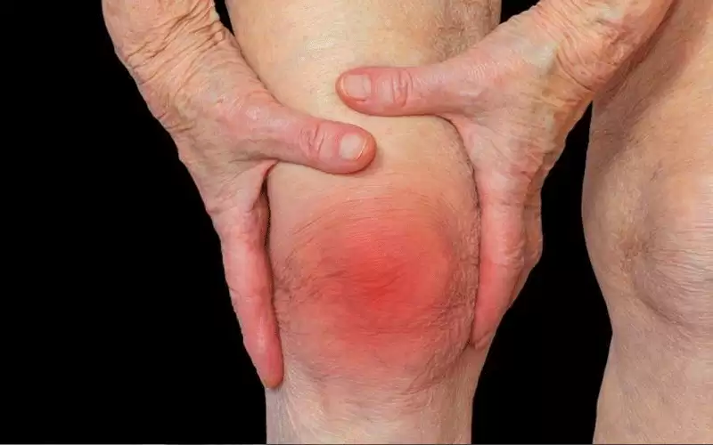 مهم للعاملين في المكاتب.. نصائح لتجنب