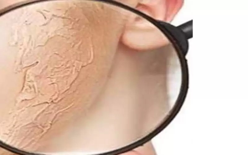 دليلك لعناية مثالية ببشرتك في الشتاء