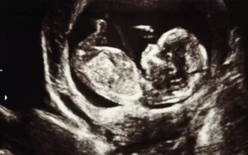 أعراض لا ينبغي تجاهلها أثناء الحمل