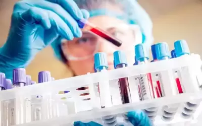 أطباء بريطانيون يقدمون علاجا رائدا لأحد
