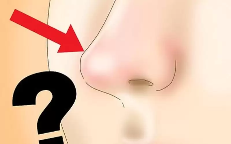 تدفئة الأنف تدعم المناعة ضد الإنفلونزا