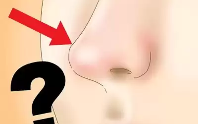 تدفئة الأنف تدعم المناعة ضد الإنفلونزا