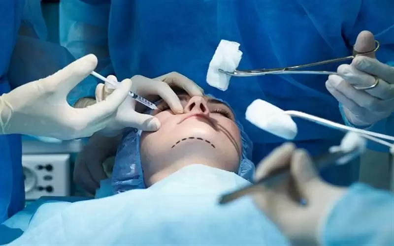 جمعية جراحات التجميل: عمليات التجميل الفاشلة