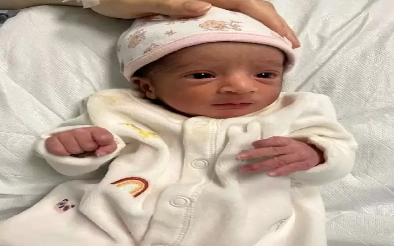 أول امرأة في العالم مصابة بمتلازمة