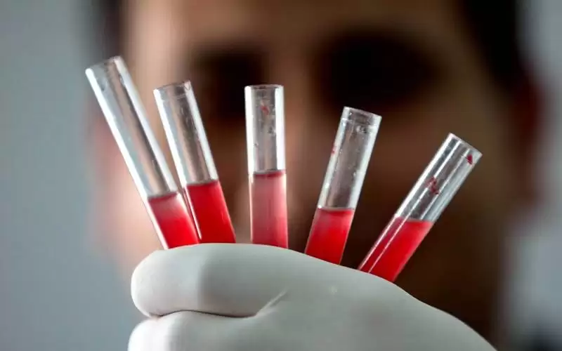 فصيلة دم نادرة .. لا يمتلكها