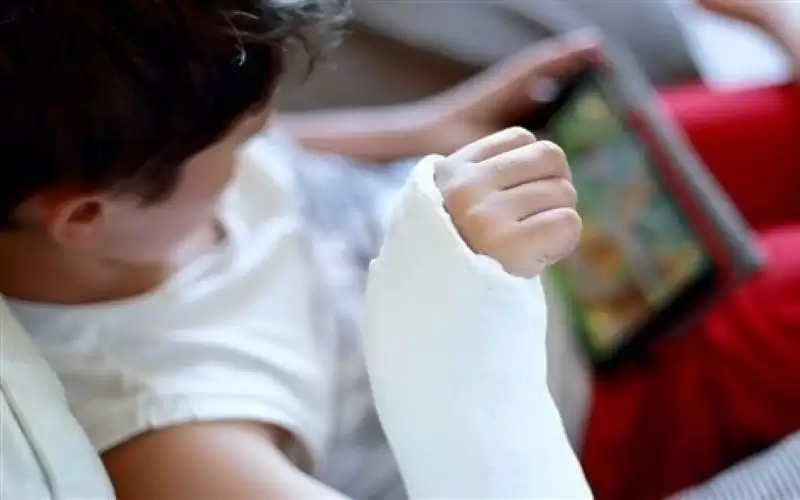 كسر العظام في الطفولة علامة خطر