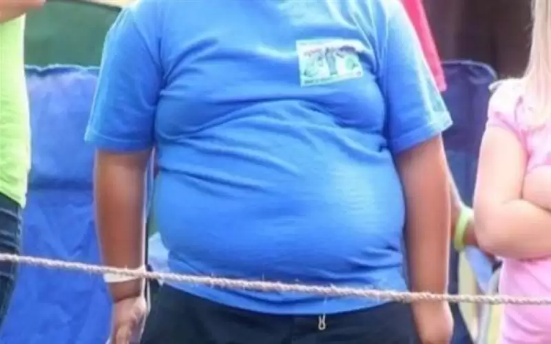 اكتشاف طفرة وراثية تسبب البدانة لدى