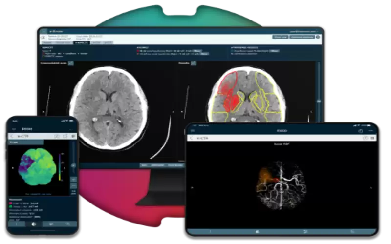 الذكاء الاصطناعي يقلص من الآثار الوخيمة