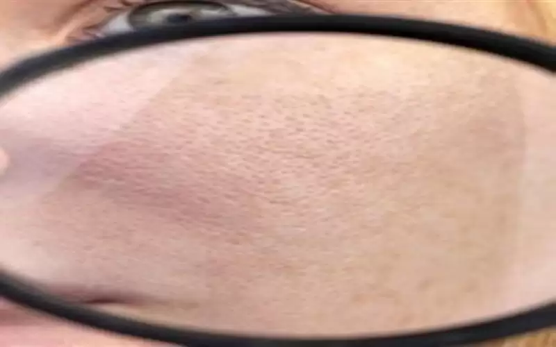 مسام بشرتك كبيرة؟ إليك الحل