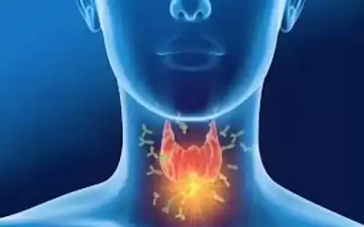 مخاطر فرط نشاط الغدة الدرقية.. انتبه