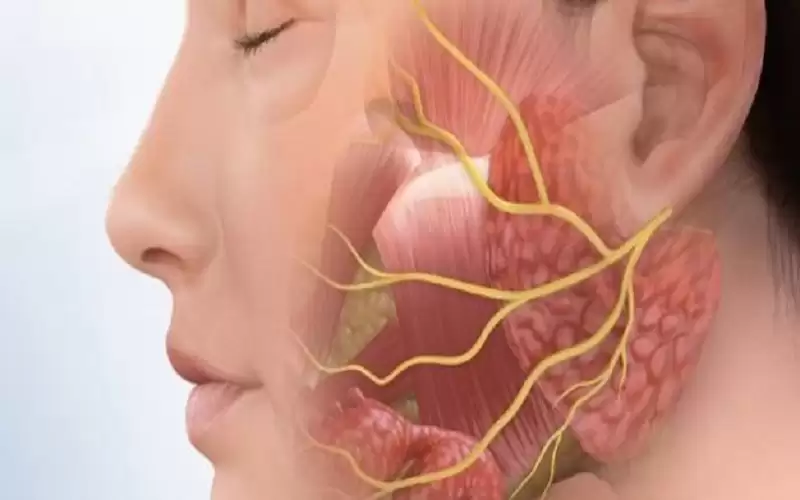 تعرفي على أعراض إصابة العصب السابع