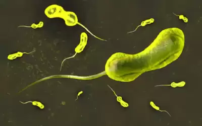 مالاوي تواجه أسوأ تفش للكوليرا.. تمديد