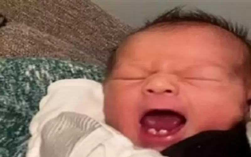 طفل يولد بأسنان يثير دهشة الأطباء