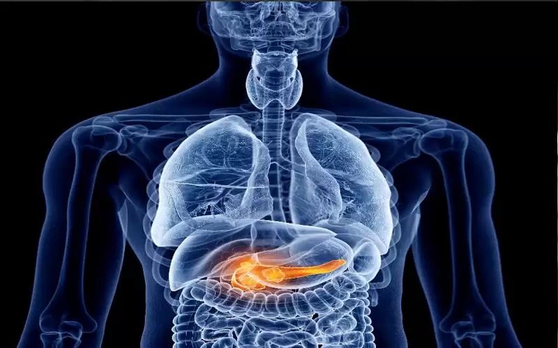 حقائق عن التهاب البنكرياس