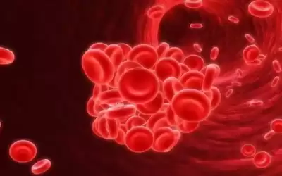 تناول هذه الأطعمة باستمرار.. لعلاج فقر