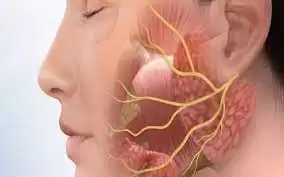التهاب العصب الخامس ما هو؟ احذر