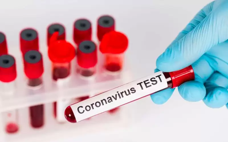 الصحة العالمية: تراجع إصابات ووفيات كورونا