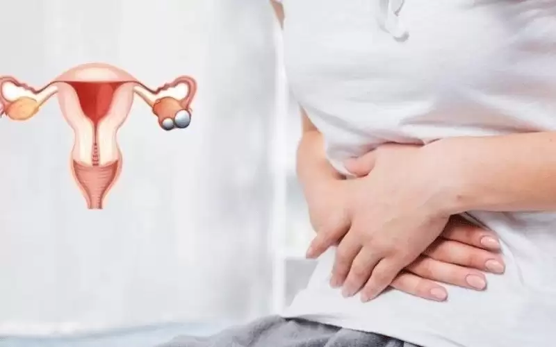 5 أطعمة تخفف من تكيس المبايض