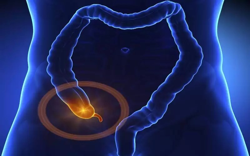 ماذا تعرف عن التهاب الزائدة الدودية