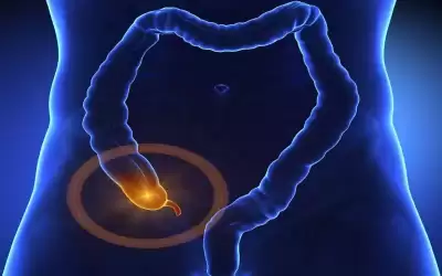 ماذا تعرف عن التهاب الزائدة الدودية