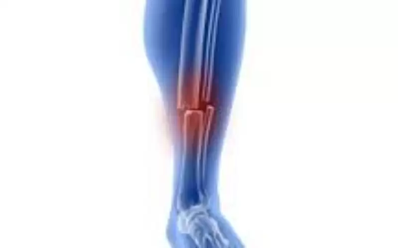 دون جراحة أو جبيرة.. تقنية جديدة