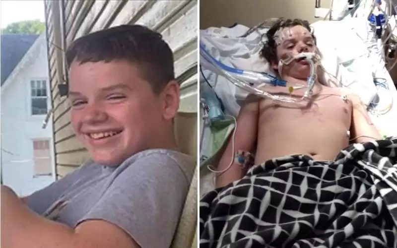 مراهق يخسر حياته بسب التيك توك