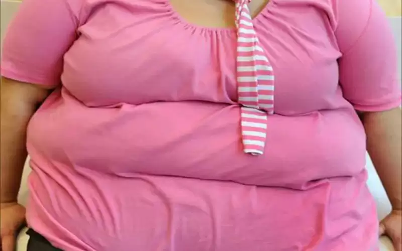 إخلاء مريضة وزنها 400 كيلوغرام لمستشفى