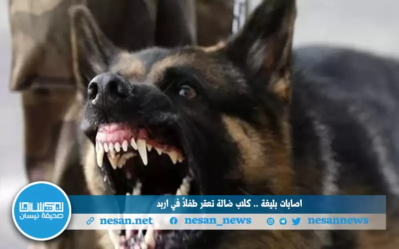 إصابات بليغة .. كلاب ضالة تعقر