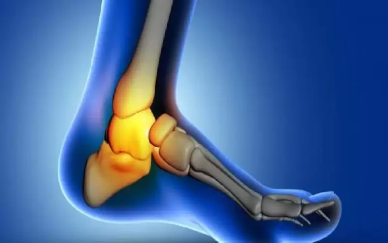 ما سبب ألم كعب القدمين؟