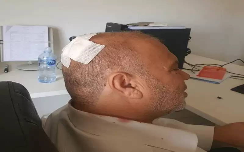 إصابة رئيس مجلس محافظة الزرقاء بحبة