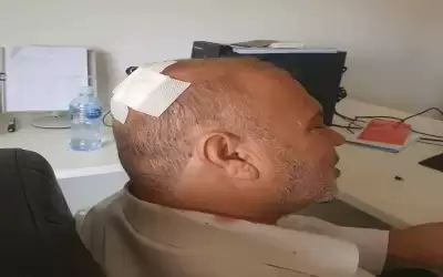 إصابة رئيس مجلس محافظة الزرقاء بحبة