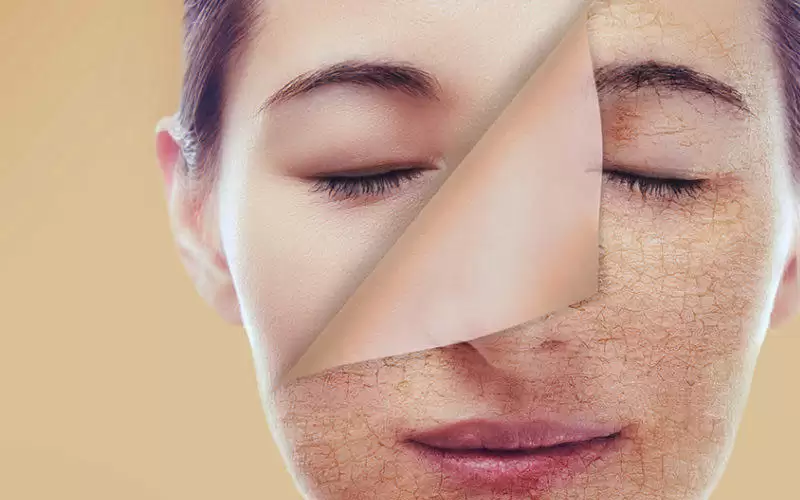 اليكم الحل الأفضل لمشكلة جفاف البشرة