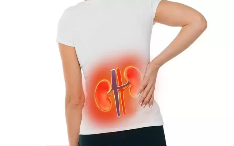 طريقة تساعد على التنبؤ باعتلال الكلية