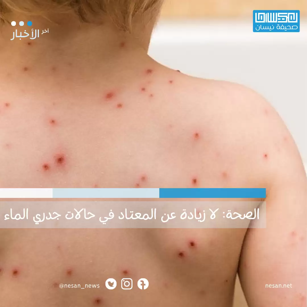 الصحة: لا زيادة عن المعتاد في