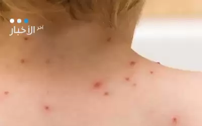 الصحة: لا زيادة عن المعتاد في