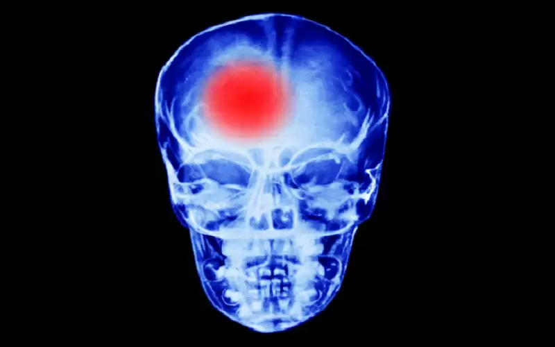 طبيب يشير إلى 4 أطعمة تعزز