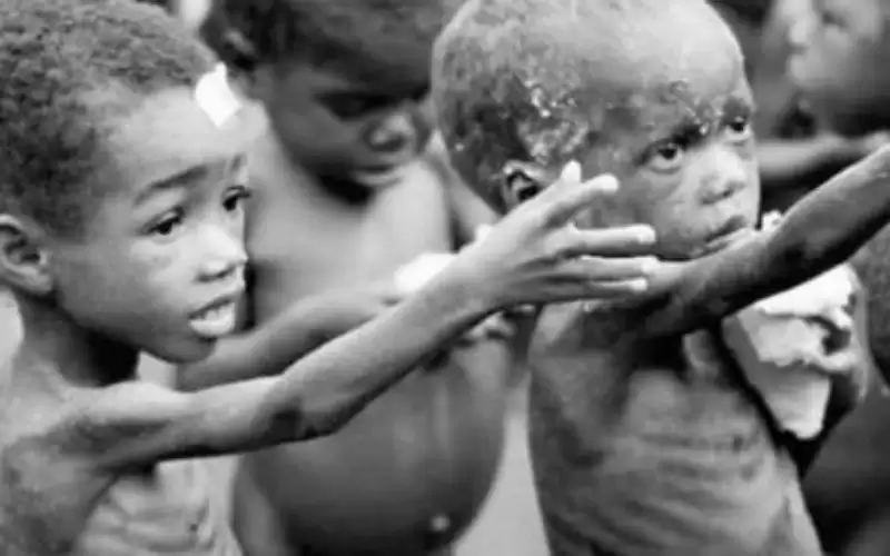 أمراض ناتجة عن سوء التغذية